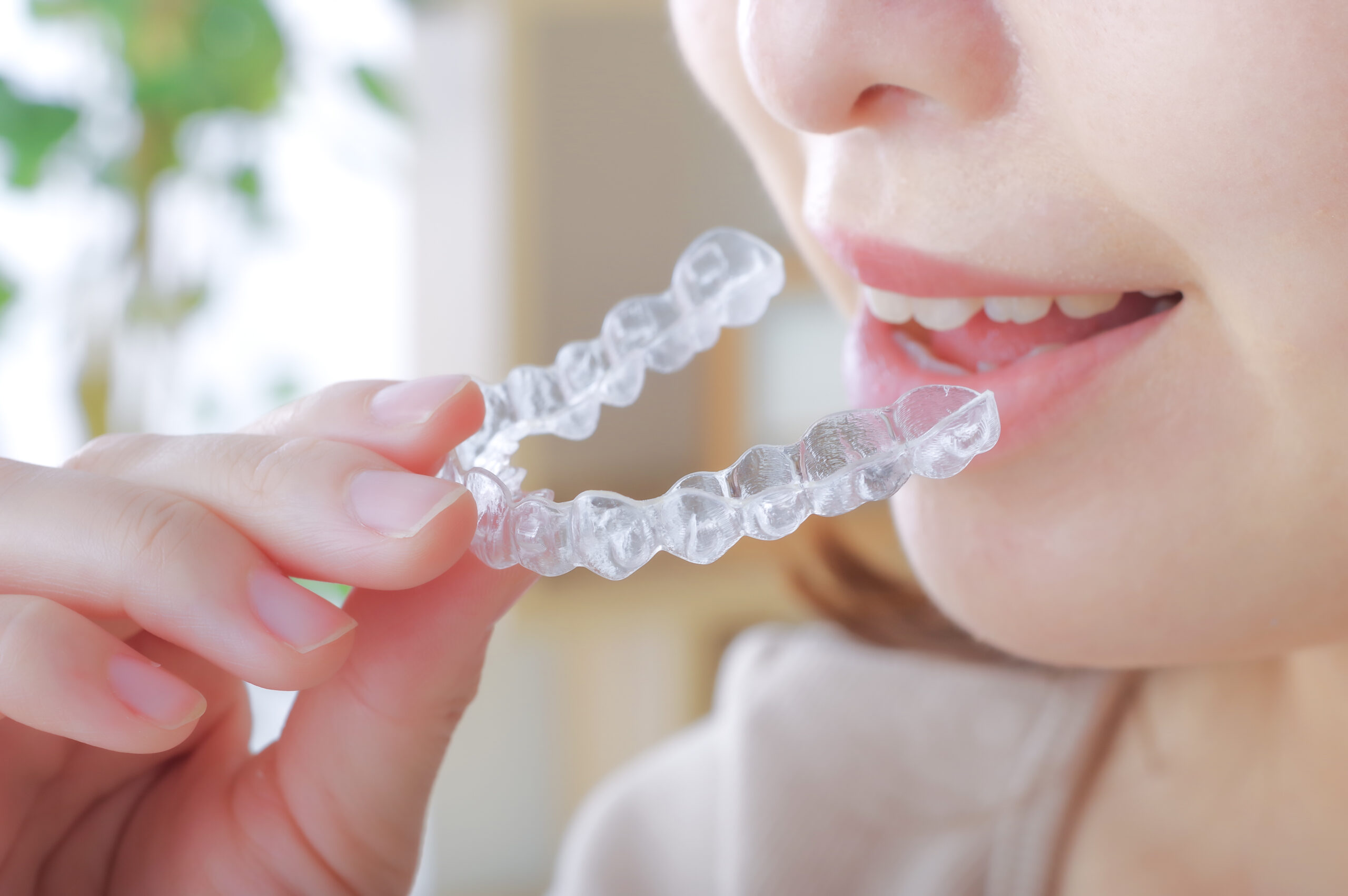 マウスピース矯正 マウスピース矯正