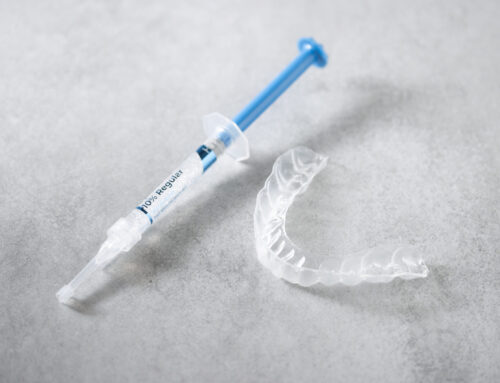 Achieve Your Ideal Whiteness at Your Own Pace! Introducing Home Whitening