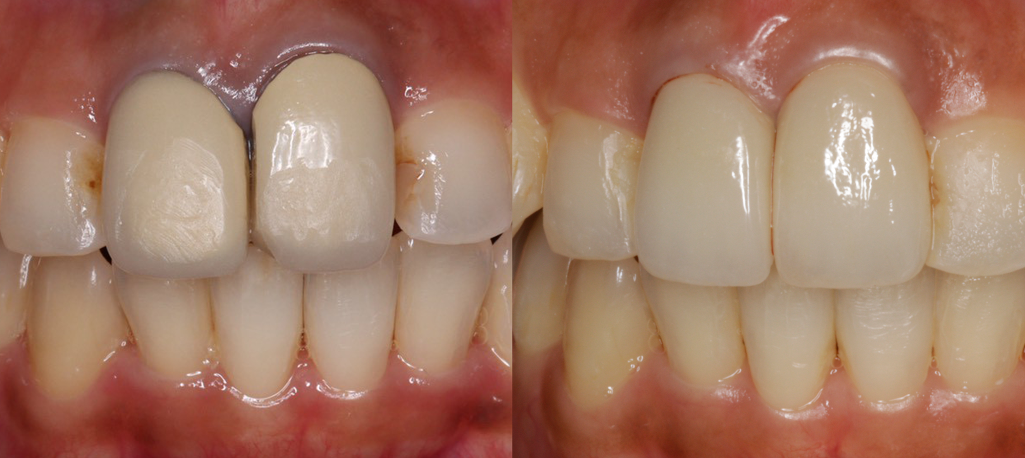 ブラックマージンの解消法